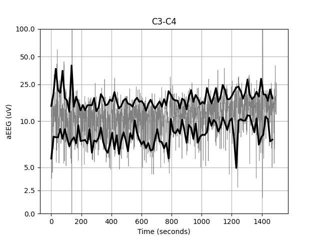 _images/a_quick_start_aeeg.png